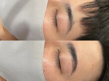 ビクシー(vixxcy)/メンズビフォーアフター