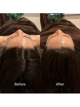 グレースフィオーレ 京橋店(gracefiore)/Before/After( 1回施術)