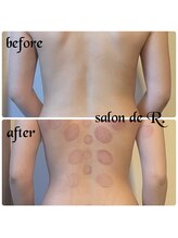 サロン ド アール(salon de R.)/【お背中骨氣20代・施術効果】