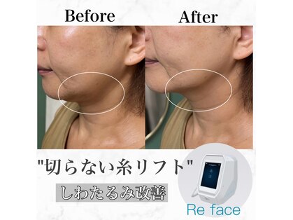 コリー(Kolly)の写真