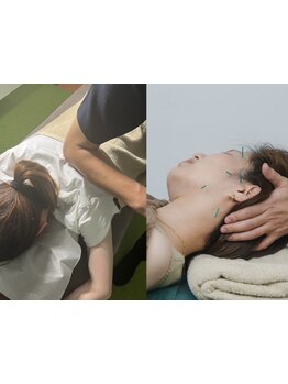 接骨院・整骨院で施術を受けたい