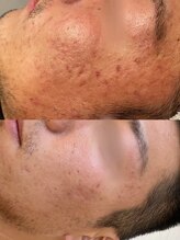 シャイネル(SHYNELL)/