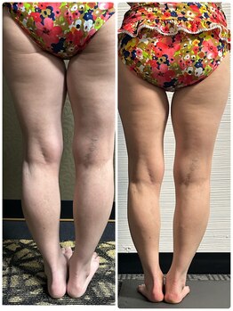 チュラ/ハイパーナイフ【所沢/秋津】