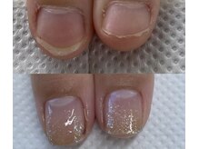 リコリサイア(ricco risaia)/むしり爪を改善し美爪へ