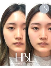 エラ アイブロウサロン(Ella eyebrowsalon)/眉毛wax + HBL