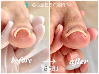 名古屋巻き爪専門Proの写真
