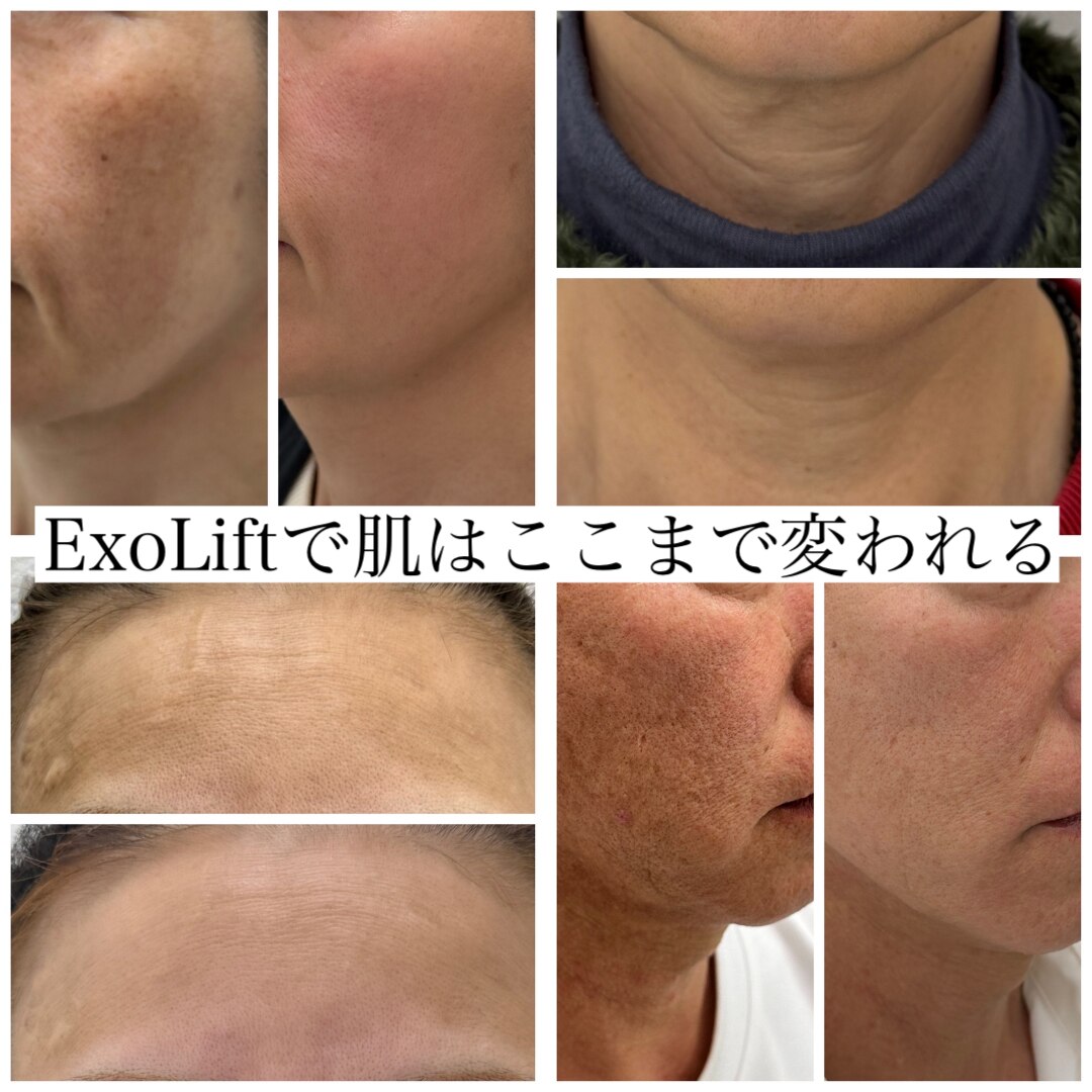 アフロディーテ(Aphrodite)｜ホットペッパービューティー