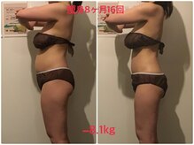 ビープロデュース 亀有店(BPRODUCE)/Before &after