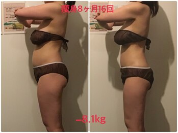 ビープロデュース 亀有店(BPRODUCE)/Before &after