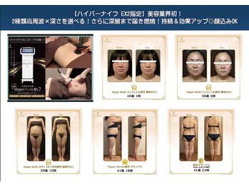 ランベリー 新宿店(Lembellir)/【ハイパーナイフ EX2専門店】