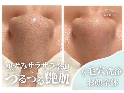 ラノン(Ranon)の写真
