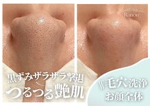 ラノン(Ranon)