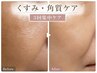 【本気の肌改善を目指す】くすみ×角質フェイシャル3回コース プレゼント付
