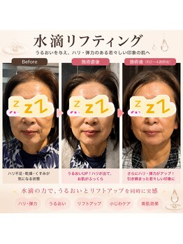 ココスタイルビューティー(COCOSTYLE beauty)の写真/年齢サインに負けない張り、ツヤ肌へ