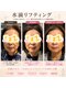 ココスタイルビューティー(COCOSTYLE beauty)の写真/年齢サインに負けない張り、ツヤ肌へ