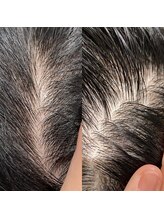 シュール センター南(SURREAL)/ヘッドスパ後のビフォーアフター