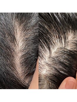 シュール センター南(SURREAL)/ヘッドスパ後のビフォーアフター