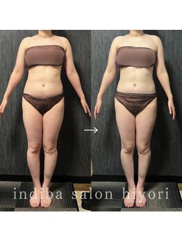 ヒヨリ(hiyori)/《before/after》body