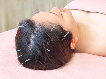 鍼灸治療院ヒカリ(hikari)/【鍼灸】３．施術
