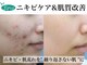 エピア 豊田店(Epia)の写真