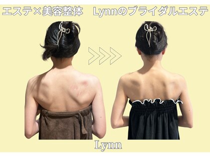 リン(Lynn)の写真