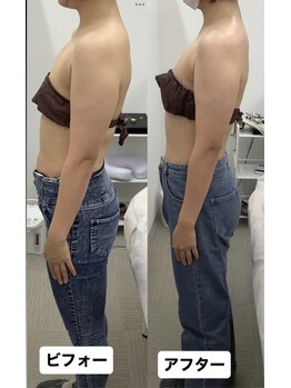 メリアミーゴ(Meli amigo)/30代 姿勢改善