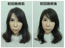 トータルバランス整体院 &nbsp;オレンジ(ORANGE)/小顔/たるみ/食いしばり/むくみ