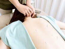 鍼灸院キクバリ(KIKUBARI)の雰囲気（「静かに体と向き合う時間」その日の状態を見ながら施術します）