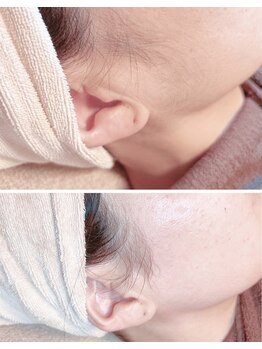 ルアナサロン(LUANA SALON)/フェイシャルワックス