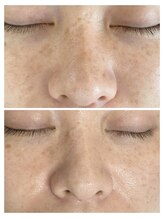 ビエストラ(Biestora)/