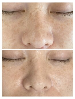 ビエストラ(Biestora)/