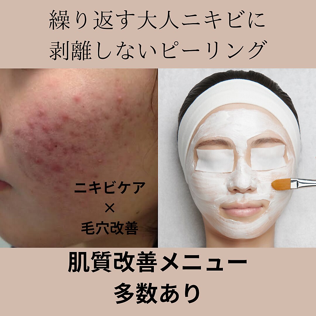 佐賀県で美肌が人気のエステサロン｜ホットペッパービューティー