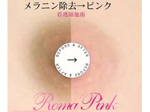 メンズ脱毛 ラミーナ 六本木店
