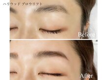 ジュイール(Jouir)/ハリウッドブロウリフト