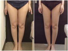 美容整体ウェリナ 名駅院/小顔矯正/骨盤矯正/美脚サロン 