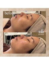 ウリ(uli beauty)/比較写真