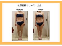 リヴェーヌ 富山店/骨盤の歪みも改善