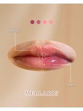 エスペランサ(Esperanza)/Lip Pink Care