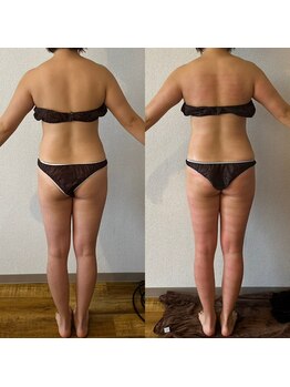 サロン マイワン(Salon MyONE)/全身ビフォーアフター背面