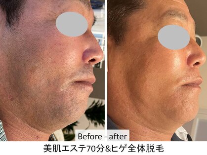 ひかり素肌の写真