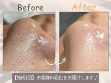 エレ(ele)の雰囲気（初めての方◎肌のごわつき、角質落としてすっきり美肌★施術1回）