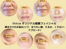 リトシア(littcia)の雰囲気（まずはお試し♪効果を実感してください！）