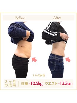 アロハ(ALOHA.)/妊娠前のズボンがラクに履ける!