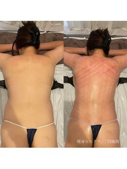 エクラ(eclat)/セルクラ