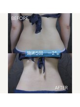 ヴィオテラス(VIOTERACE)/