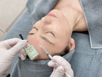スムース(smooth)の写真/【肌の代謝を促進して想像以上の水光肌に】静岡希少！ワイコ水光ピール★毛穴引き締め/即艶/リフトアップ
