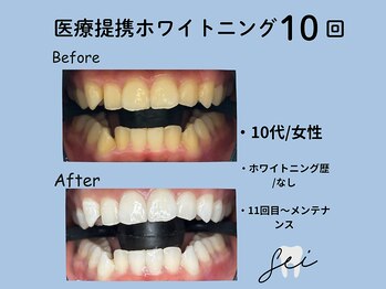 セイ(sei)/症例写真　ビフォーアフター