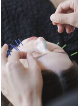 ハーバシー ラボ(herbacie LABO)/即効性の高い美容施術