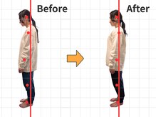 青山バランスアップ治療院の雰囲気（ストレートネックを矯正！頭痛、肩こり、自律神経症状を改善！）