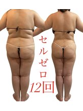 リノア(Lino'aka)/30代　○○さんの変化　痩ボディ